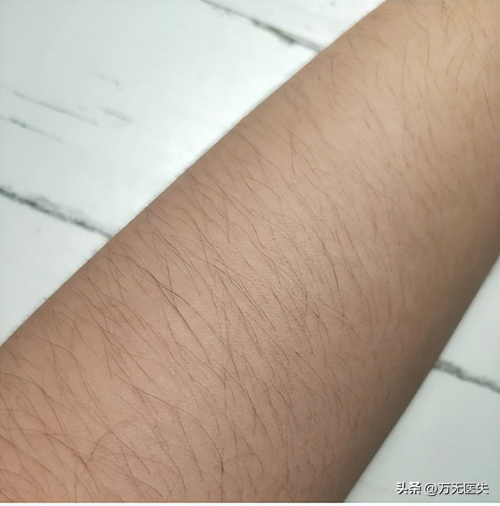 为什么有人“下面”没毛？女性*处私**毛发的秘密，别羞于了解