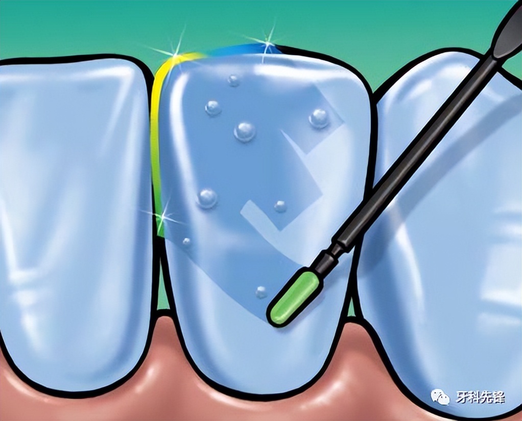 家长必知的儿童口腔知识,健康宣教口腔知识