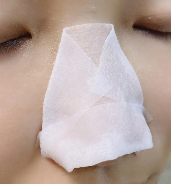 去鼻子上的黑头最好的方法,去鼻子上黑头的有效方法