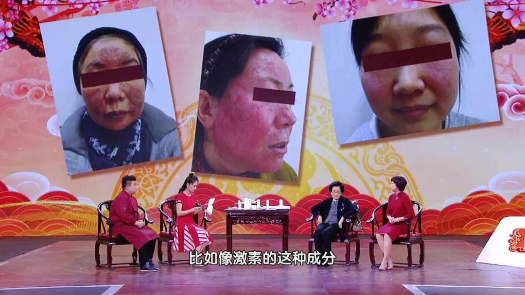 头皮屑多洗发水不应该有什么成分,头皮屑越洗越多真的只怪洗发水吗