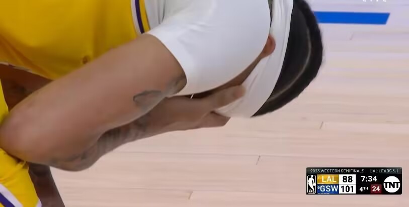 浓眉被卢尼犯规,卢尼肘击浓眉会被追加停赛吗