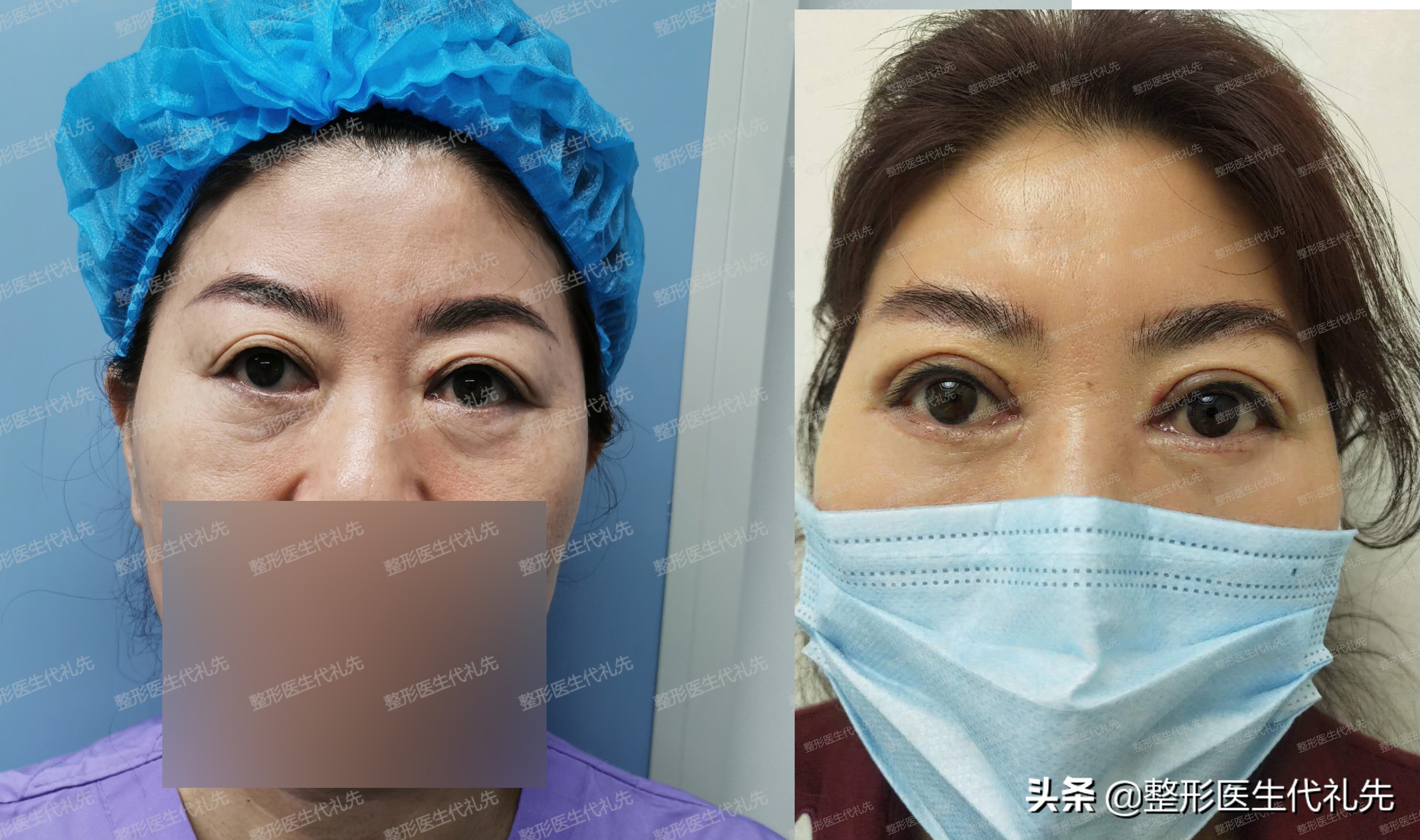 女性40岁怕衰老需要美容,女性40岁抗衰老