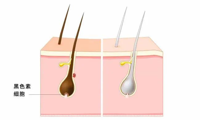 白头发到底能不能拔？在线等~挺急的！