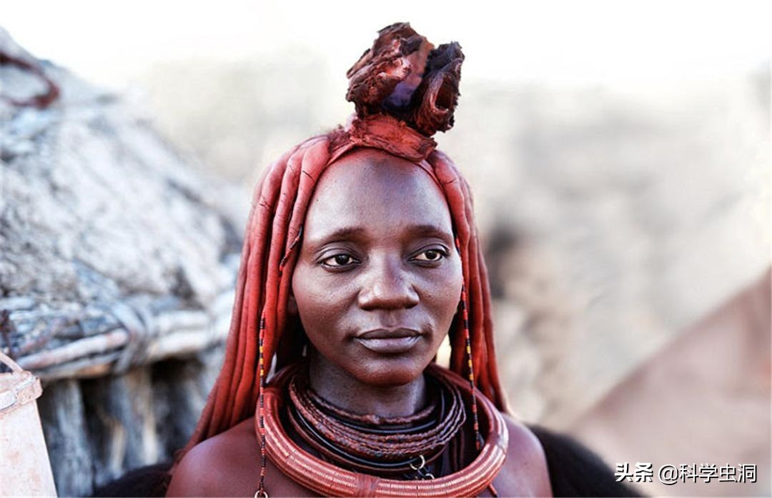 洗澡搓下来的黑泥到底是什么？显微镜放大100倍，画面不忍直视