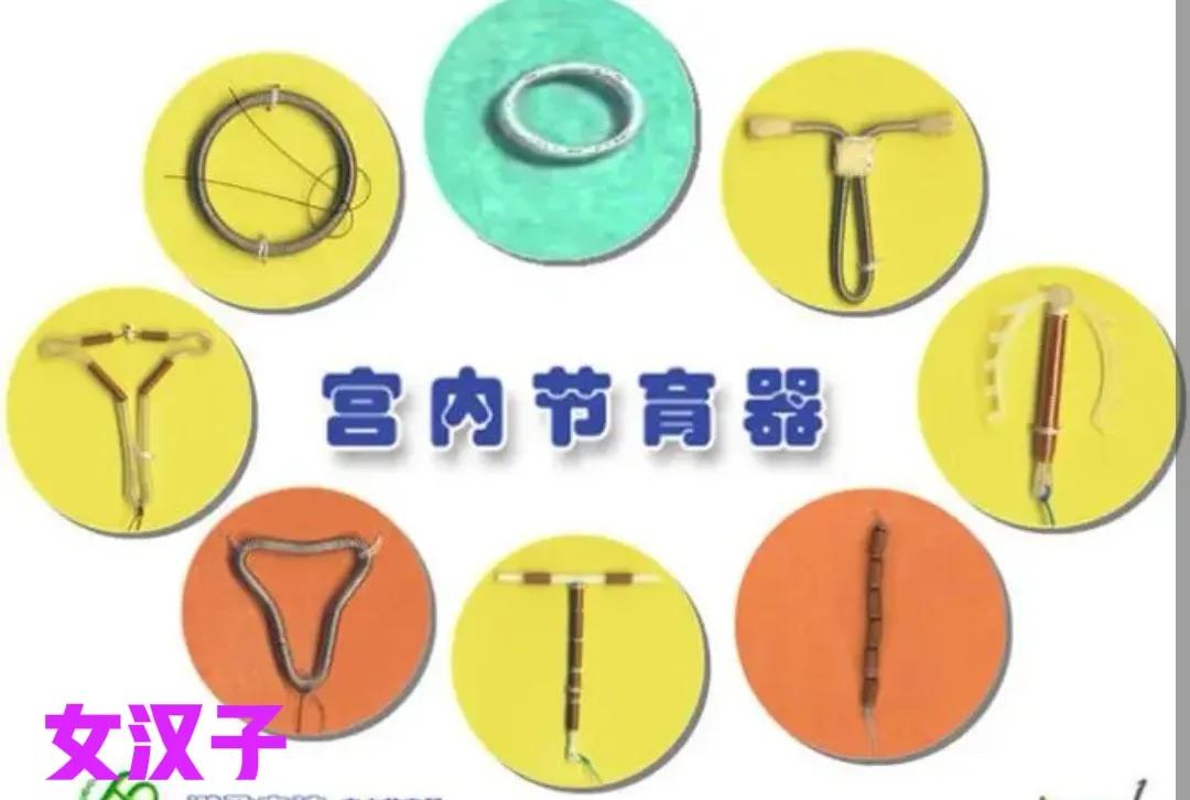 五花八门的节育环,各种节育环的价格和优点