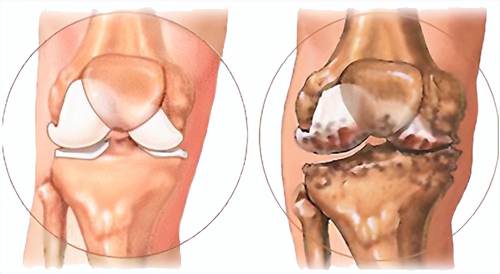 给骨伤关节痛病患“稳稳的幸福”——记西安市中医医院曲江院区创伤关节科