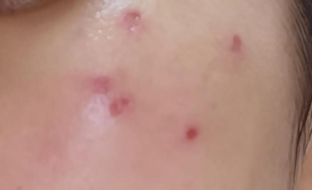 去医院美容科看皮肤靠谱吗,毁容美容