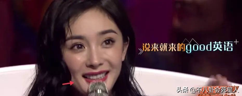 杨雪的脸怎么了,杨雪毁容了吗