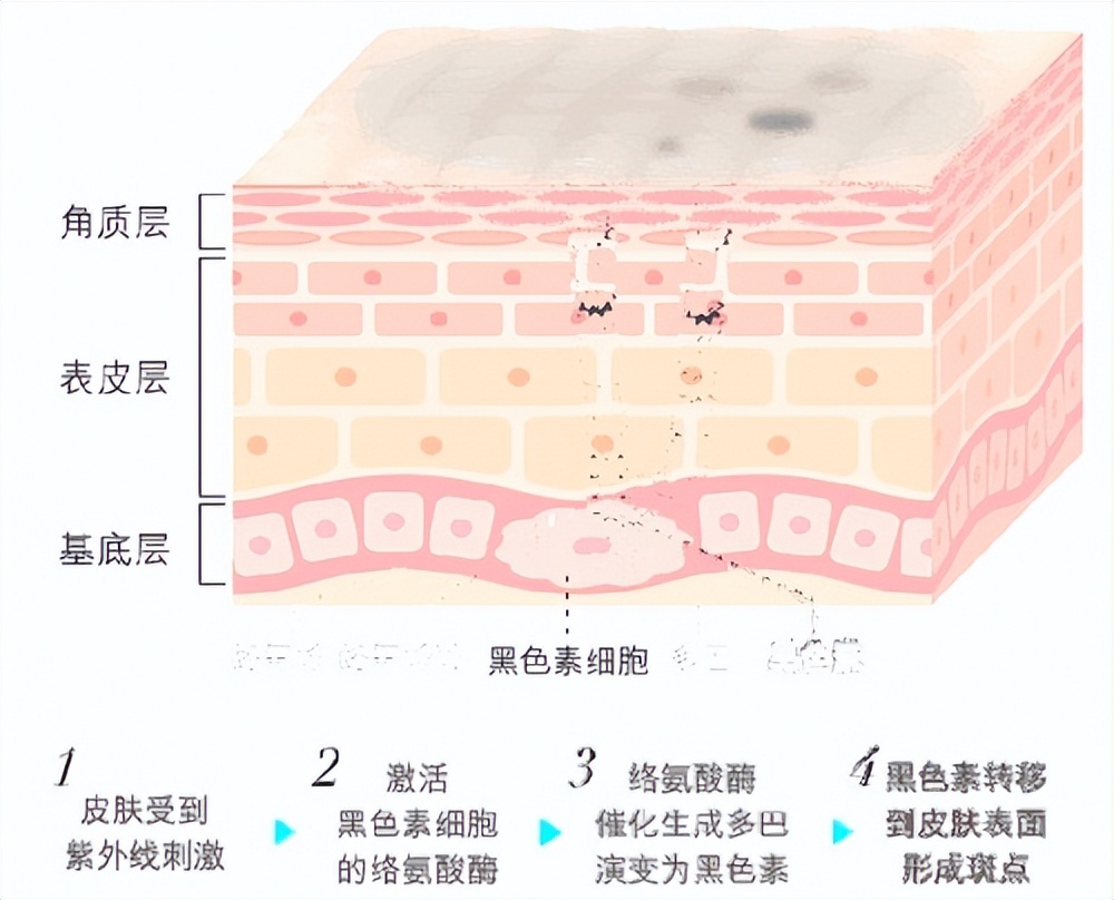 泰国芮一蚕丝面膜效果怎样,泰国芮一面膜怎么样