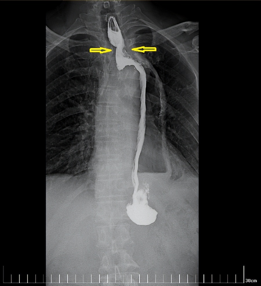 西安国际医学中心磁波刀,西安市国际医学中心肿瘤手术