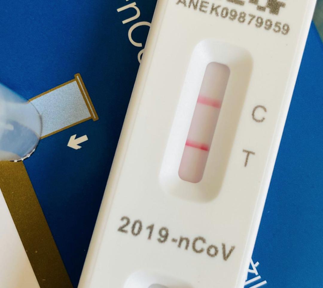 一家三口发烧后的表现不一样,一家三口反反复复发烧