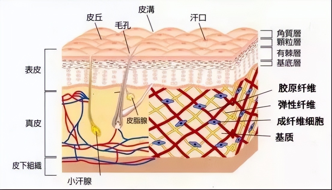 有祛除肥胖纹的真实案例吗,隐形肥胖怎么消除