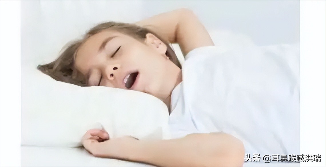 儿童腺样体肥大需要注意什么事项,饮食上怎样预防宝宝腺样体肥大