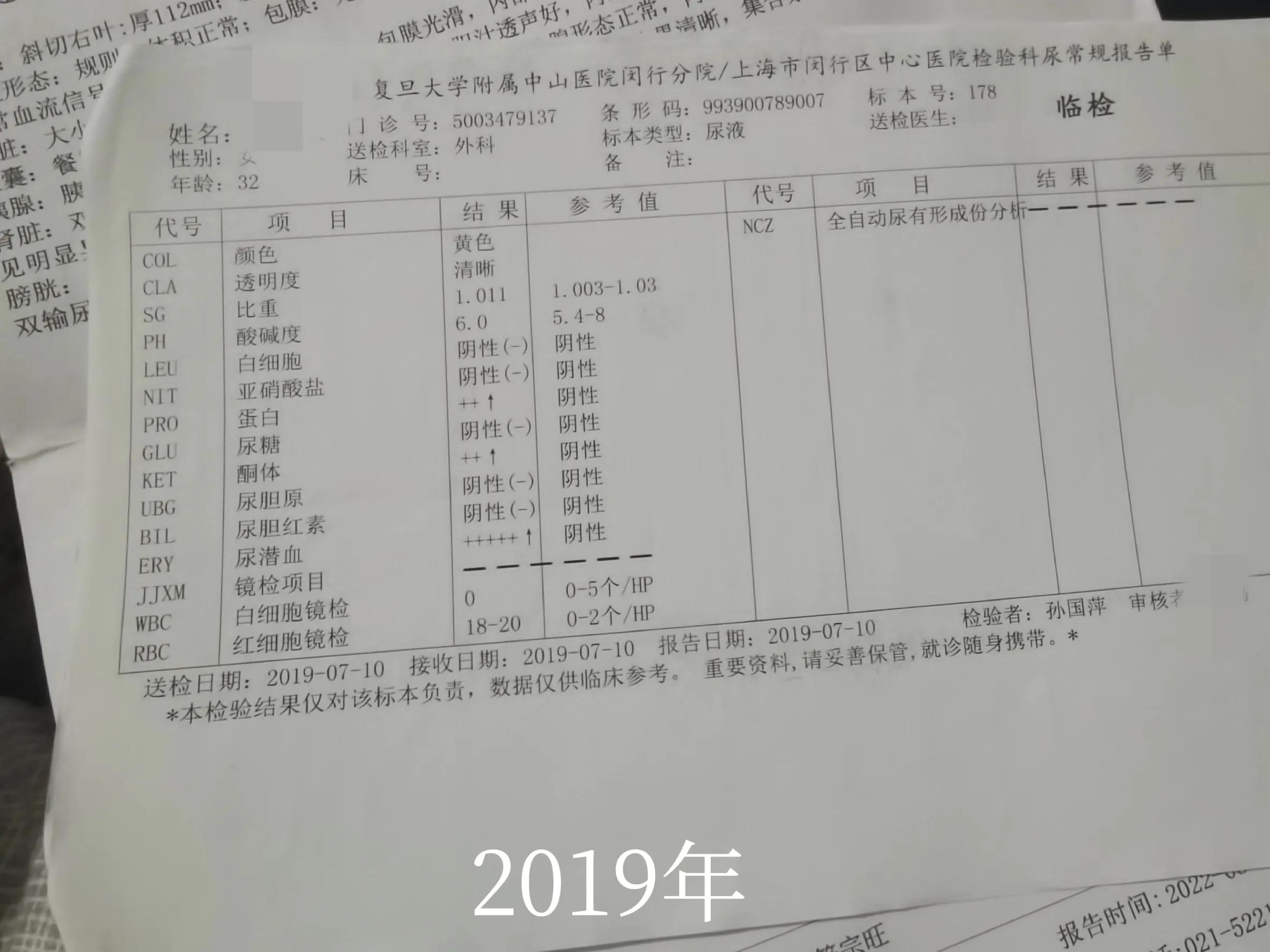 从发现肾炎到治疗，我被医生耽误几年的时间