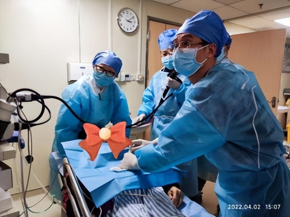 经皮胃镜下胃造瘘术操作步骤,什么是经皮内镜下胃造瘘