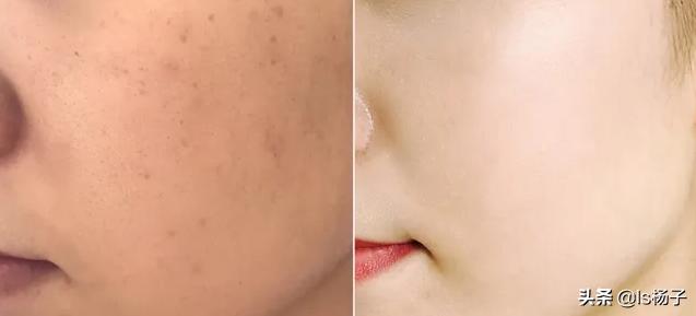 如何使皮肤变白的简单方法,让肤色变白的最快方法