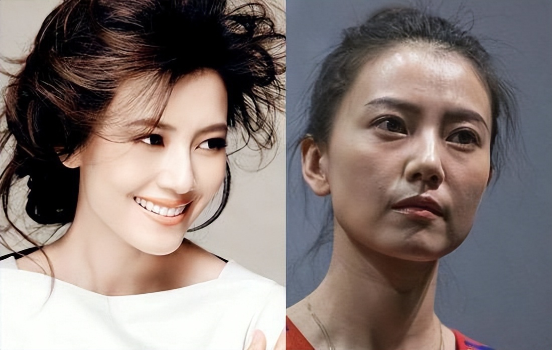 泰国女子打6年美白针六胜肽,女子打美白针后身患多病