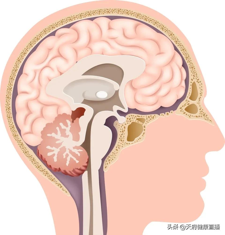 手术治疗帕金森病要多少费用,手术治疗帕金森效果怎么样
