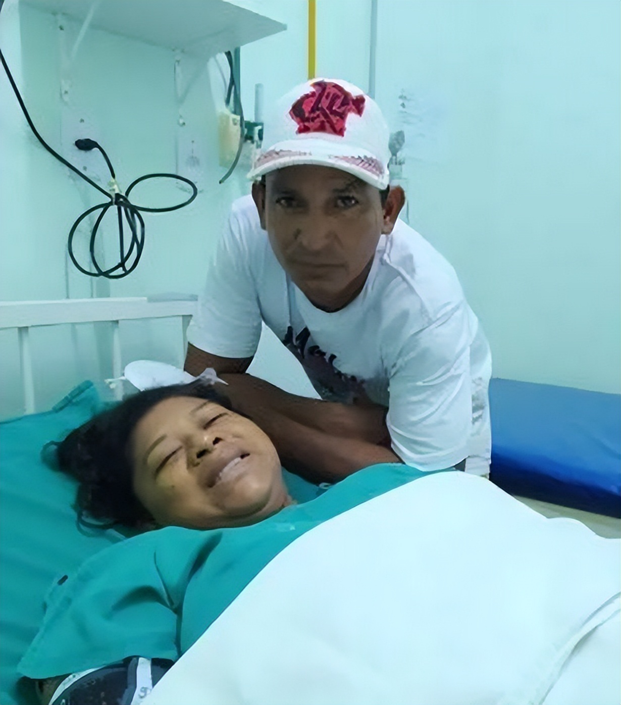 7公斤巨婴,巴西女子生下双头婴儿