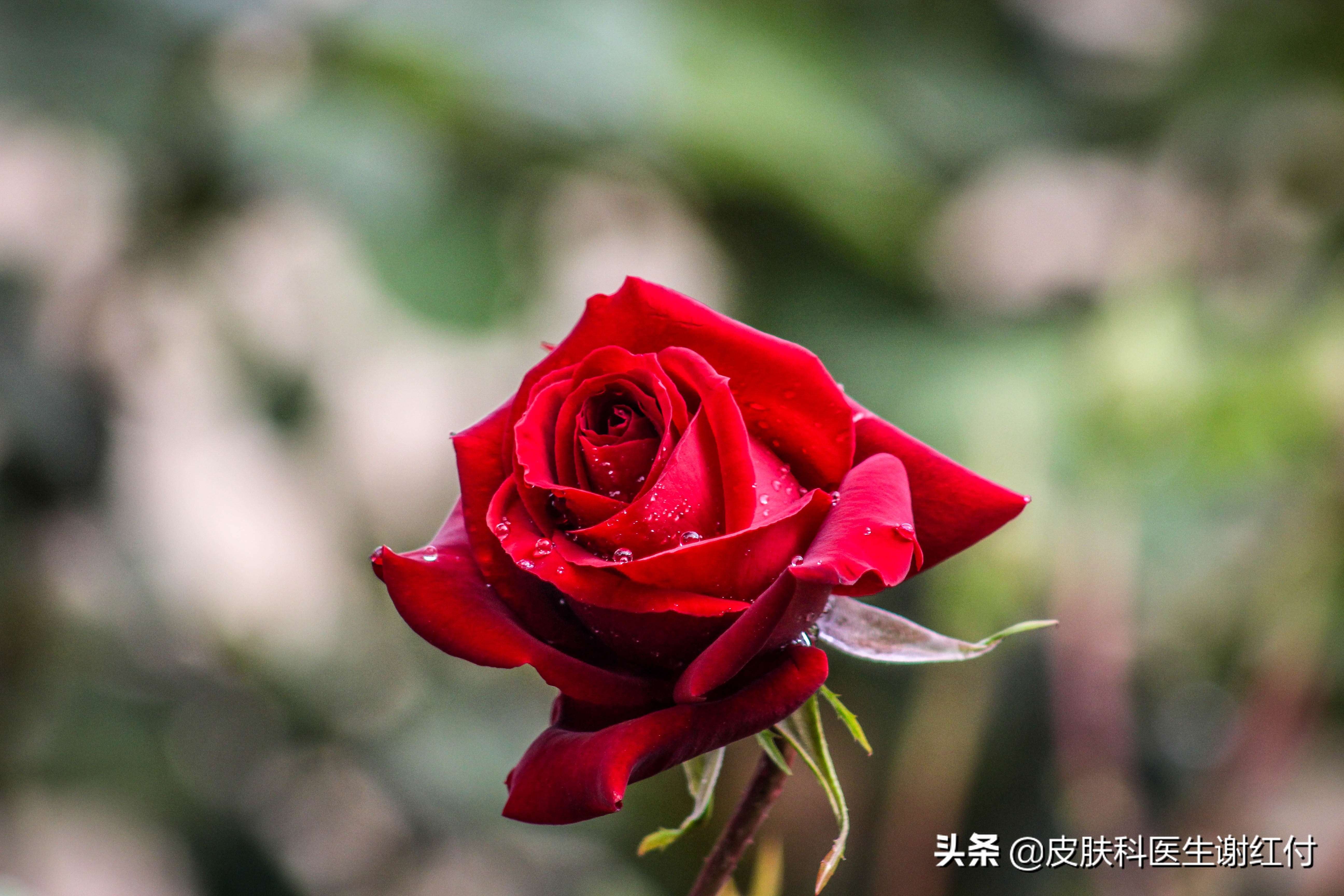 玫瑰痤疮的克星是什么,玫瑰痤疮问诊