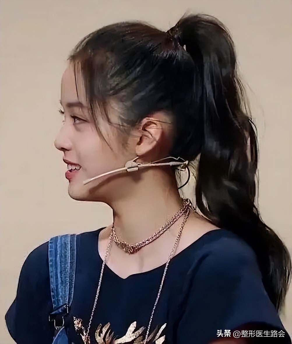 塌鼻子做什么样的鼻子安全,塌鼻子应该选择哪种隆鼻