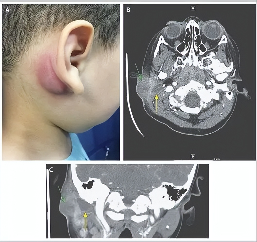 小石头学习法,小石头学武功