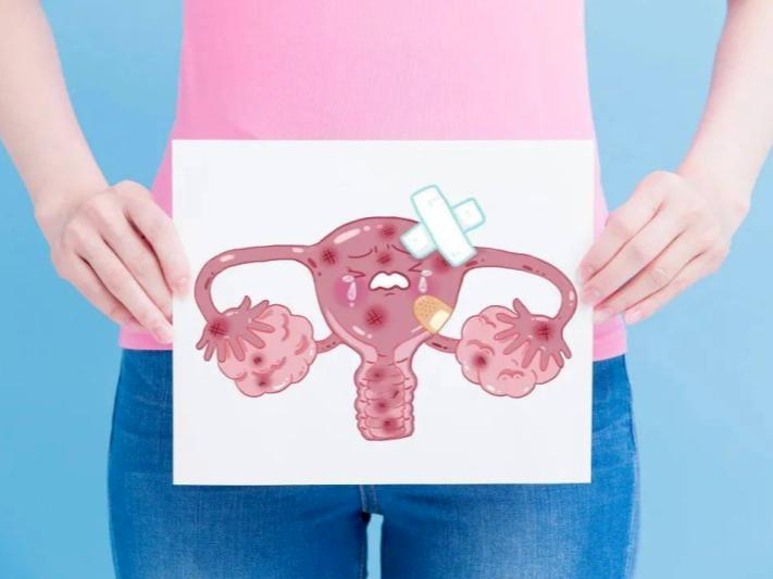 子宫内膜息肉，别再剖宫了，中医有妙方！