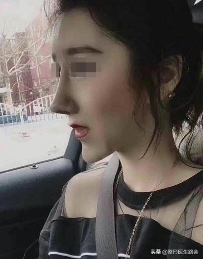 三甲医院鼻整形医生,鼻子整形医生科普类视频