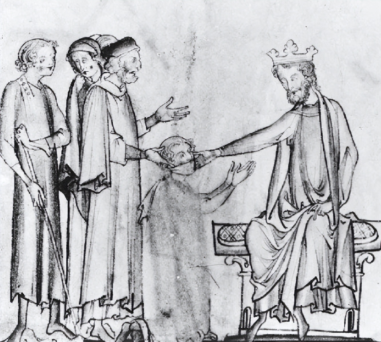 法国国王的最离奇的治疗方法,国王摸头治病