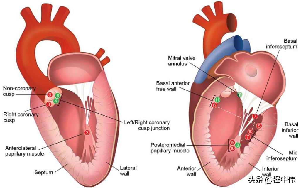 室性早搏鉴别诊断及治疗,心脏室性早搏怎么治