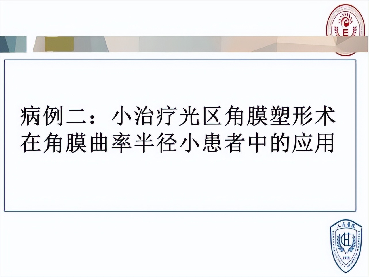 王凯角膜塑形镜原理,王凯医生塑形镜