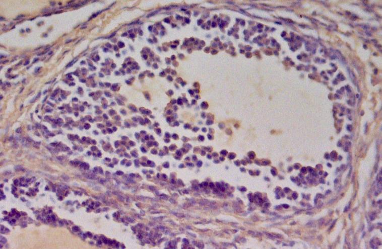 男人胡子长意味的什么,男人胡子长得快是什么病