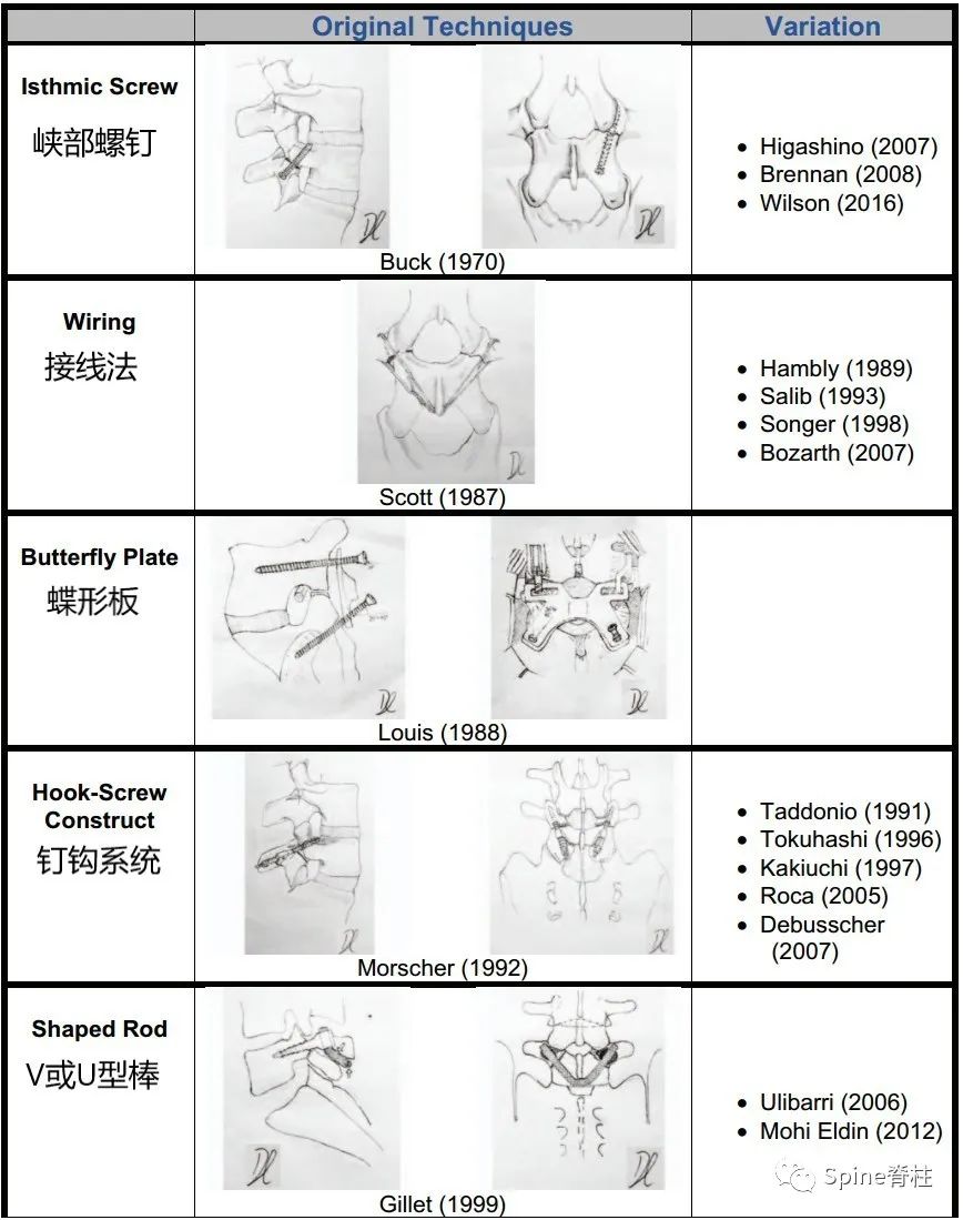 轻度峡部裂和重度峡部裂的区别,真性峡部裂和假性峡部裂