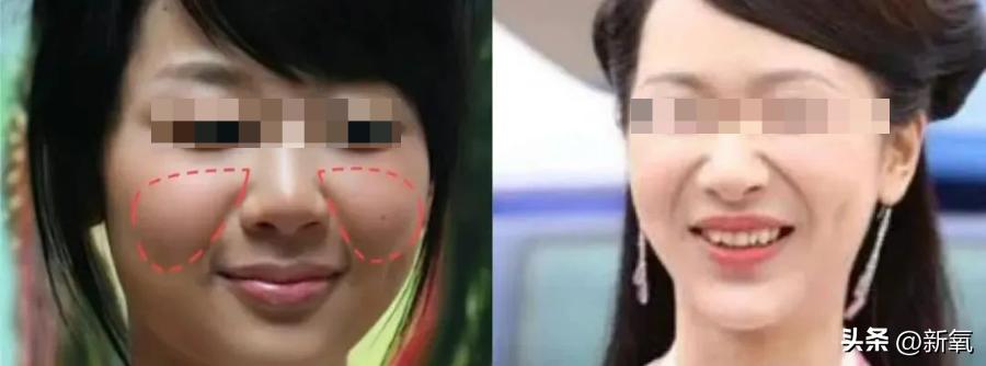 盘点各大女明星笑容合集,笑起来眼睛也会笑的女明星