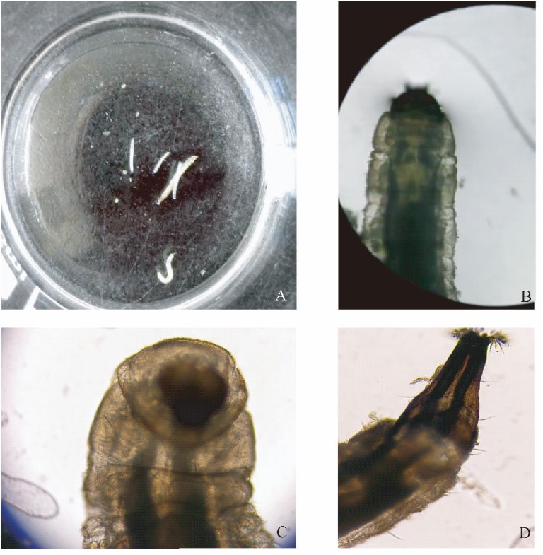 卫生间小飞虫的危害程度超乎你的想象,它究竟是啥?该如何消灭?