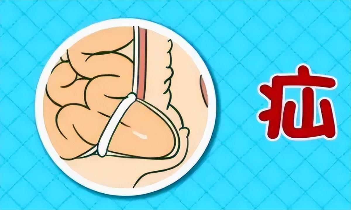 河北省儿童医院小儿疝气,医院开展中国疝气日义诊活动