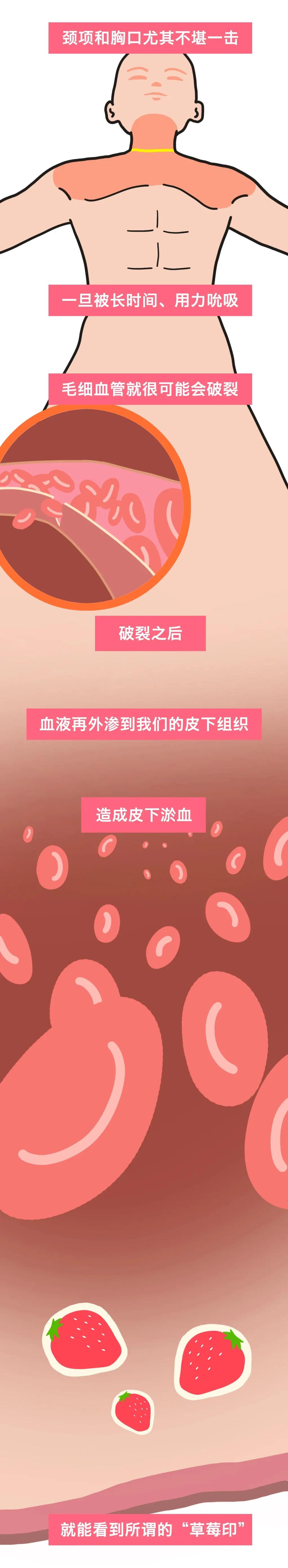 为什么男生喜欢在女生脖子上种草莓？