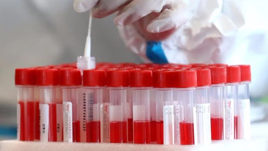 核酸检测是不是去公立医院比较好,民营的核酸检测报告有效吗