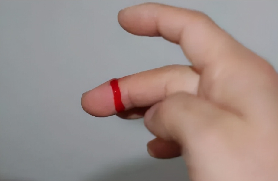 宝宝磕碰划伤怎么处理,孩子磕碰擦伤了怎么办