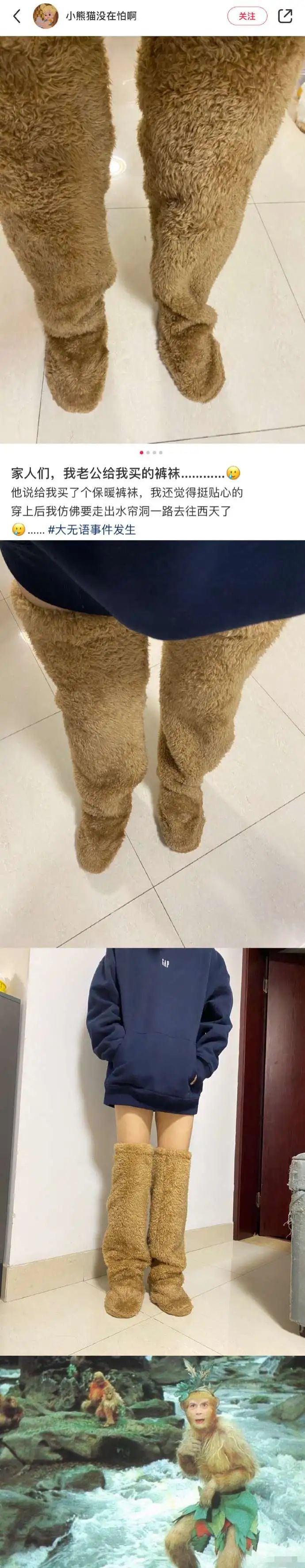 割包皮被反复收费,包皮手术为什么说是医疗骗局