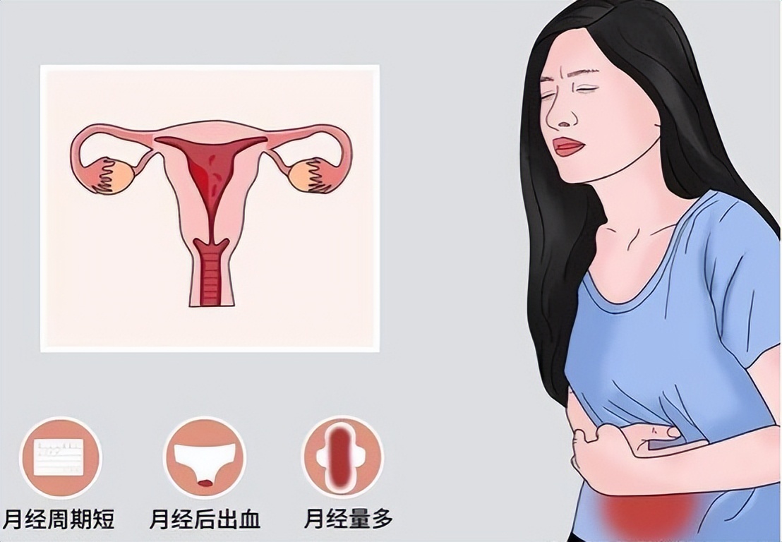 子宫性不孕要如何诊断,查不孕不育查出宫颈病变