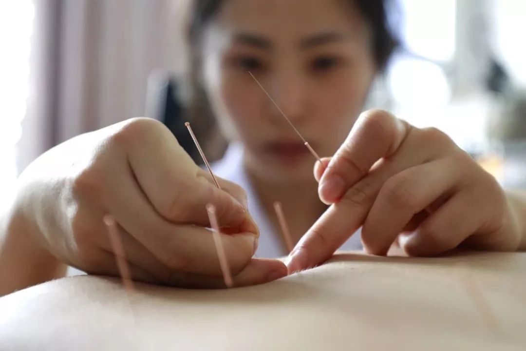 中医针灸治疗腰痛病的学术思想,古法针灸临床治验