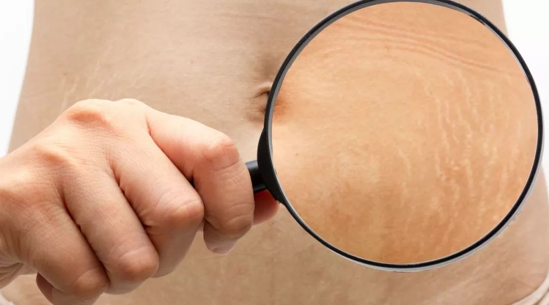 怀孕会有哪些痛苦?你想知道的都在这了,看完就不焦虑了!