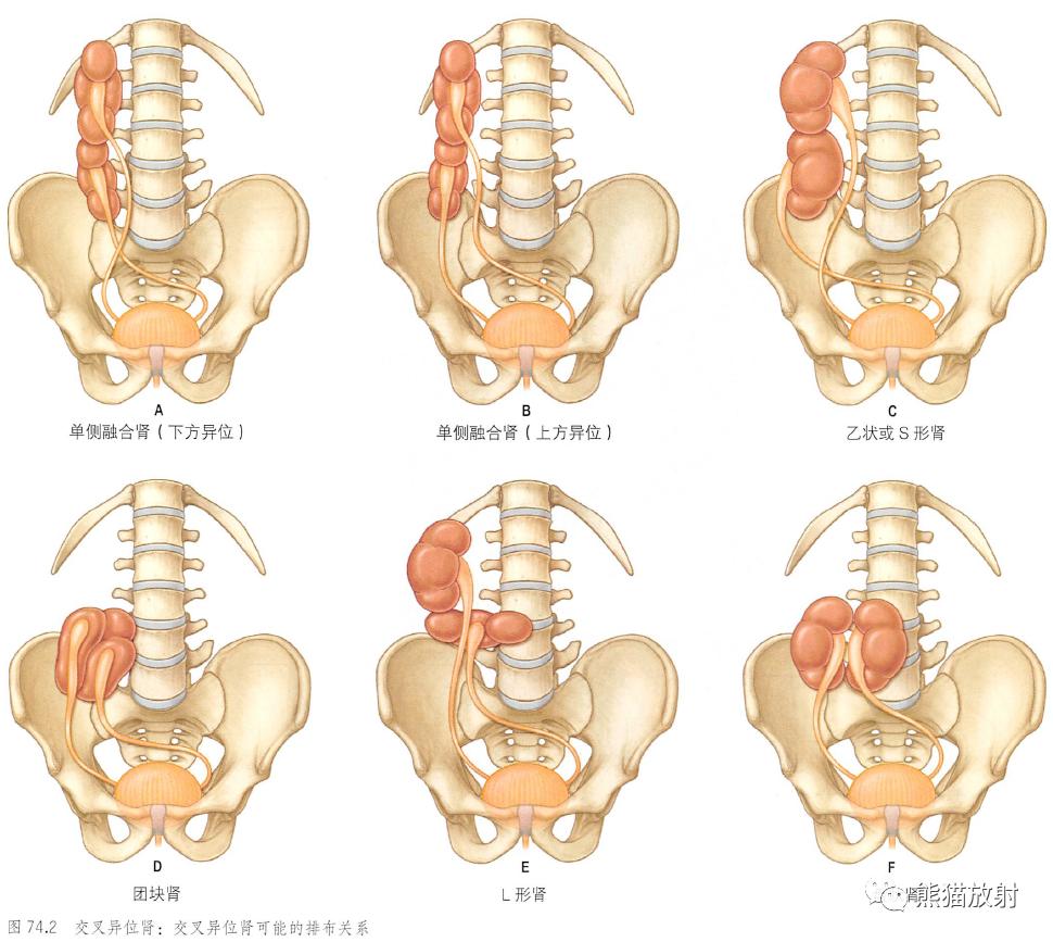输尿管和髂血管解剖,脾胰解剖图