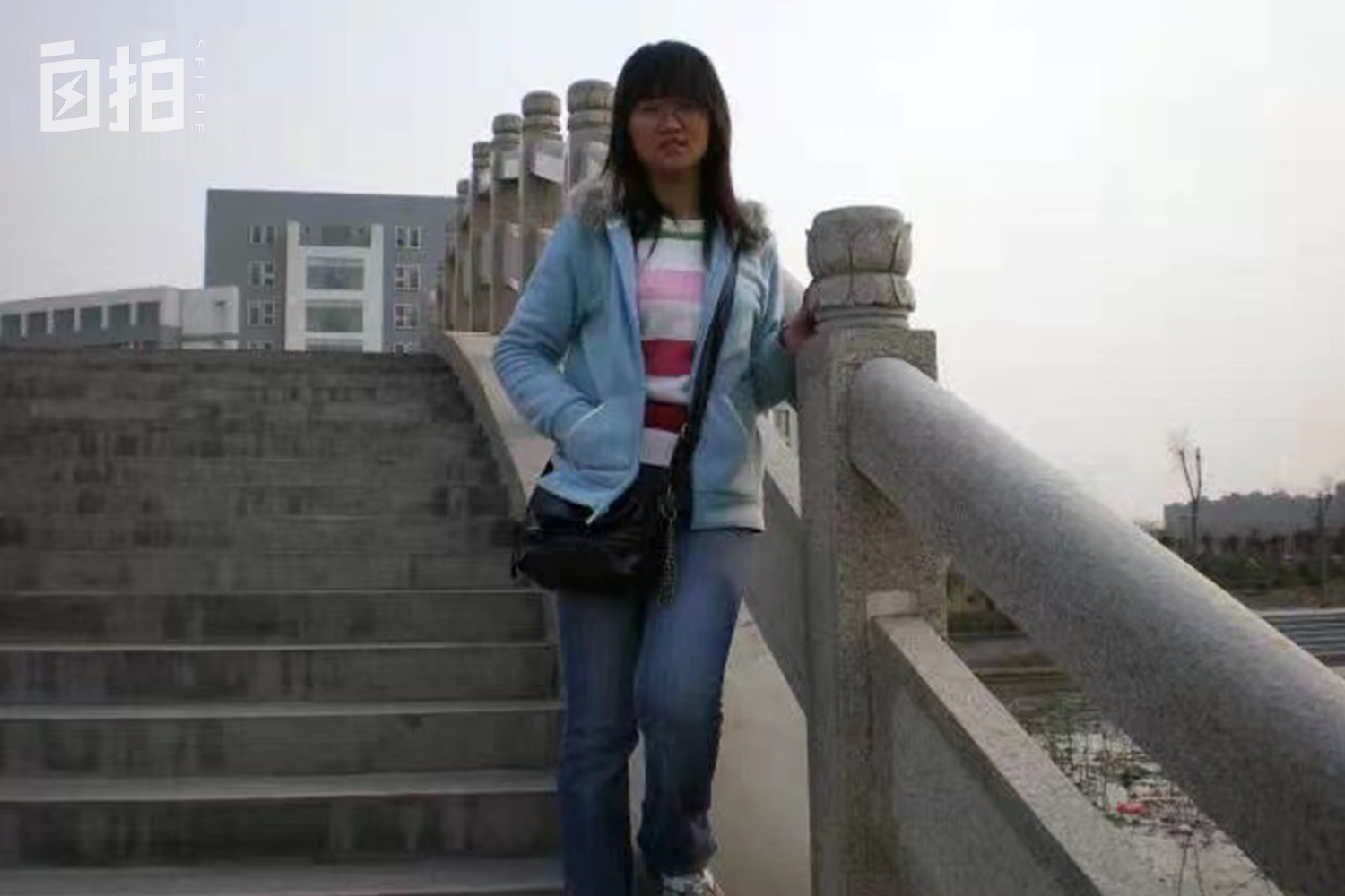 鍏堝ぉ鎬уけ鑱墜鏈垂澶氬皯,澶辫仾鎵嬫湳鎭㈠鍚姏