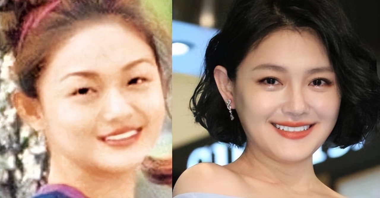 明星坦言瘦脸针,女明星瘦脸针