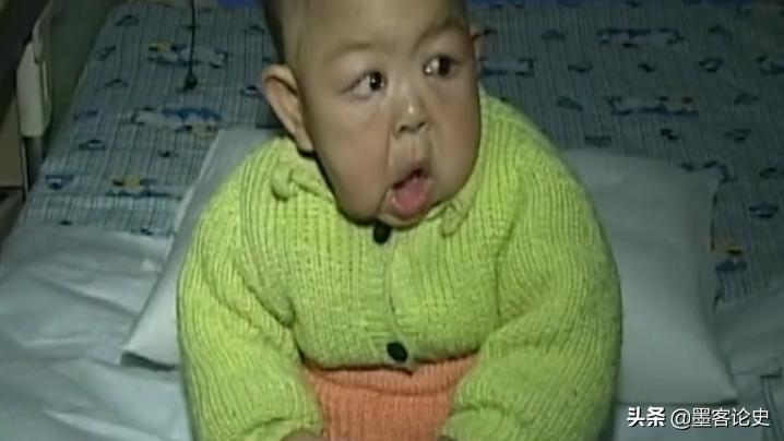 故事:河南1岁女婴患早老症,一夜变成80岁老人,母亲含泪千里求医
