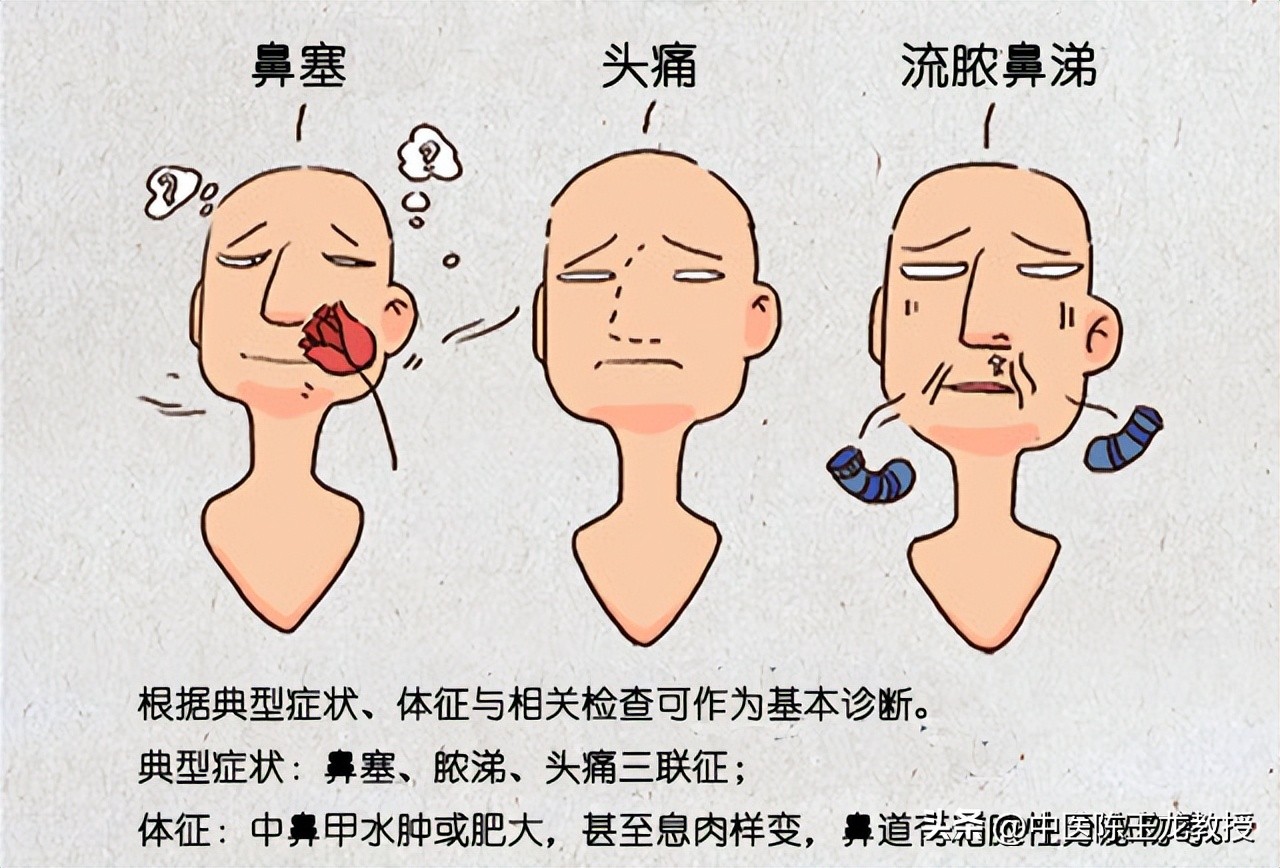 头微痛鼻塞吃什么药,急性鼻窦炎鼻塞怎么缓解