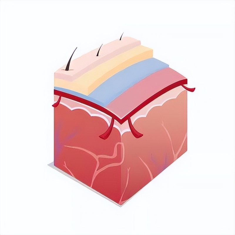 毛孔越来越粗大是什么原因导致的,毛孔越来越粗大怎么处理