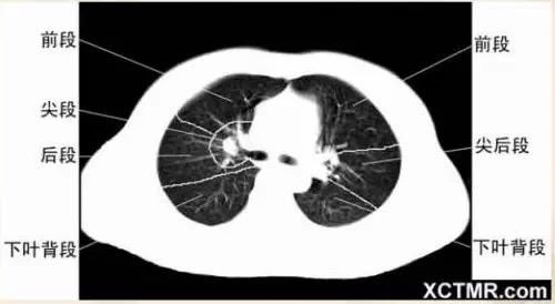 胸腹部盆腔ct主要检查什么,女性盆腔ct断层解剖结构图